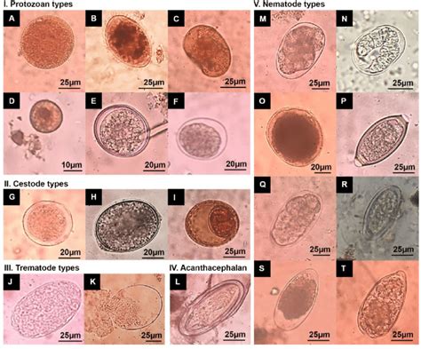 examples of parasites in stool