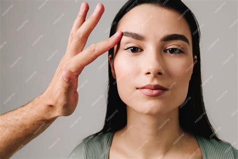 Blepharochalasis ‘drooping eyelids that raised our eyebrows