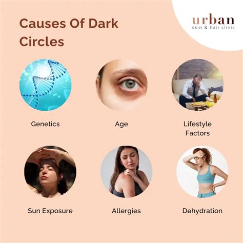Exercise Causes Dark Circles