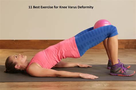 Exercise For Knee Varus