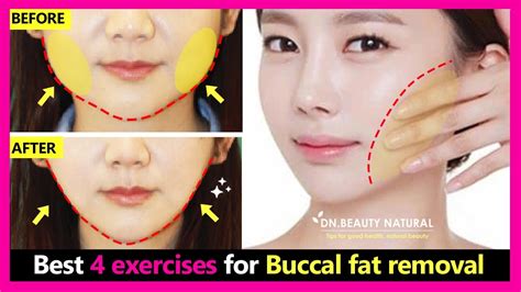 exercise to reduce buccal fat