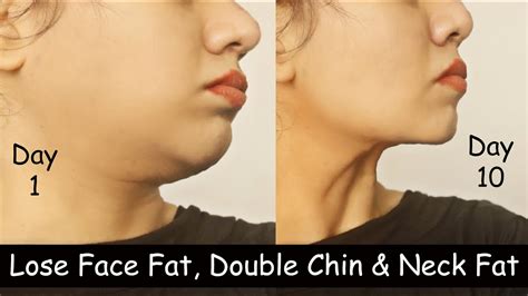 exercise to remove double chin face