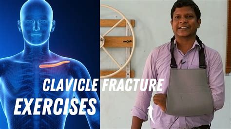 exercise with a broken collarbone