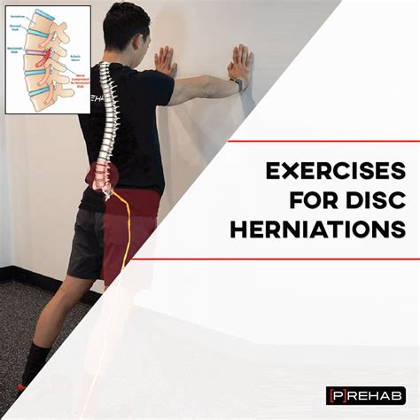 exercises allowed with herniated disc