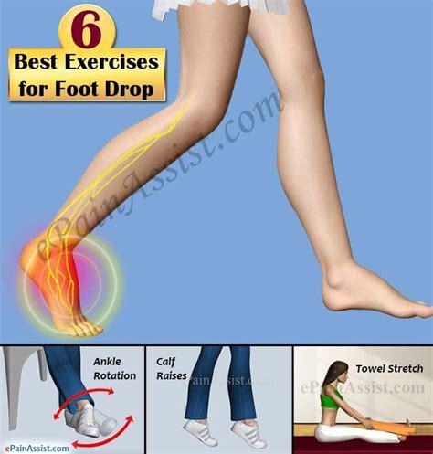 exercises for drop foot recovery