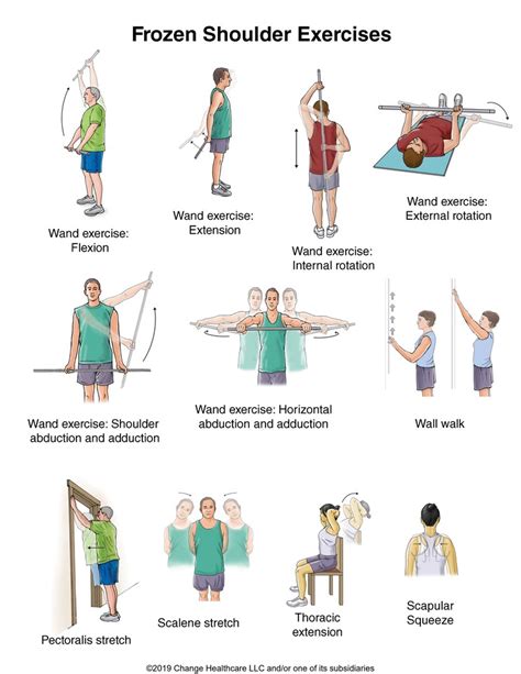 Relieve Pain: Effective Exercises for Frozen Shoulder Recovery
