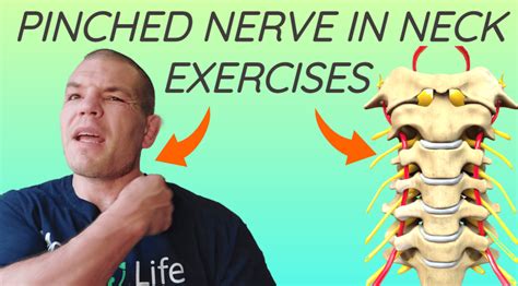 exercises to help a pinched nerve in your neck