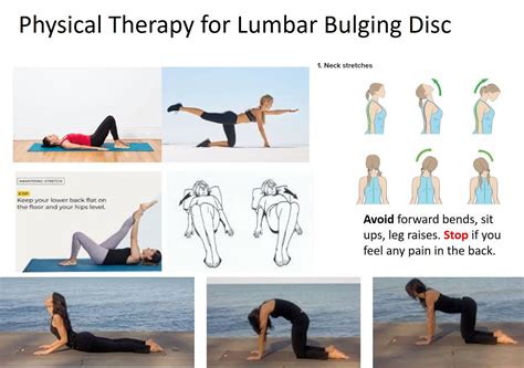 exercises with bulging disc
