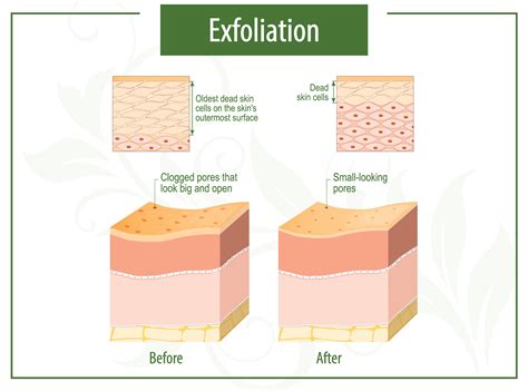 Exfoliation Action Definition