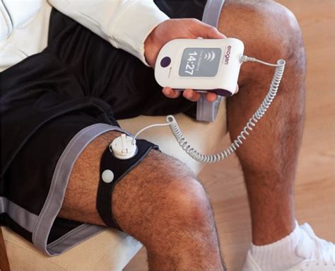 Boost Bone Healing with Exogen Bone Stimulator Technology