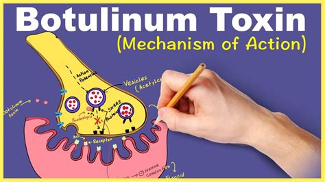 explain how botulinum toxin works