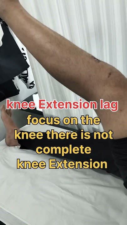 Extension Lag Definition