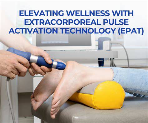Extracorporeal Pulse Activation Technology: Tips, Benefits, and What to Expect in 2026