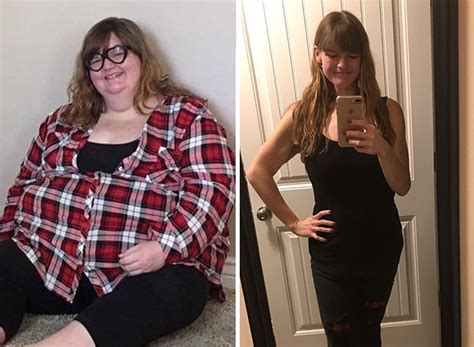 extreme weight loss stories