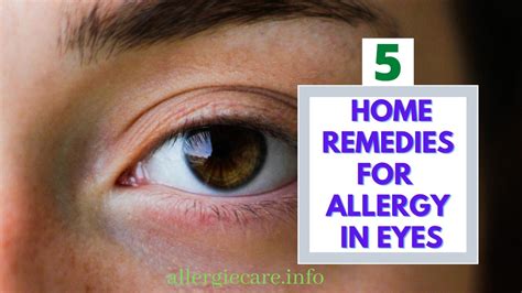 A Homemade Cure 15 Natural Allergy Remedies You Should Try Out
