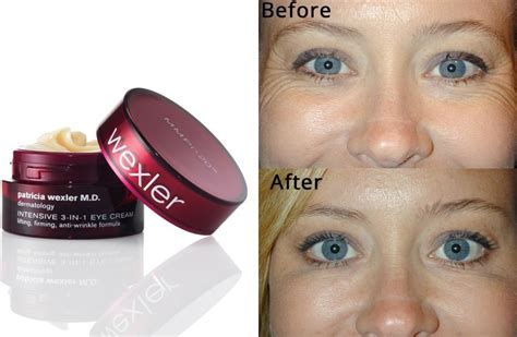 eye cream for wrinkles and crow's feet