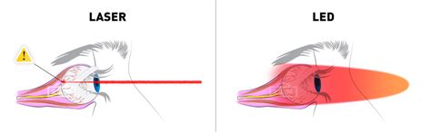 Eye Damage From Red Light Therapy
