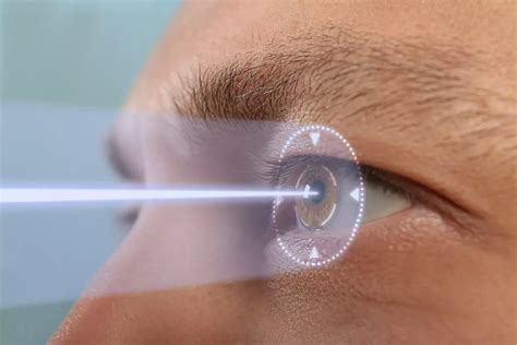 Transform Your Vision with Advanced Eye Laser Vision Correction