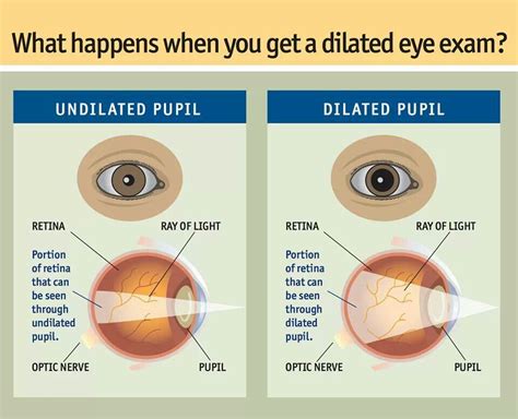 Eye Mapping Vs Dilation
