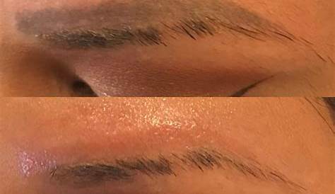 Eyebrow Tattoo Removal Cream Reviews DIY How To Remove Botched At Home