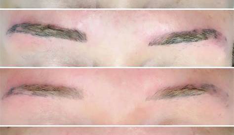 Eyebrow Tattoo Removal Recovery 617 Likes 48 Comments EYEBROW TATTOOS OMBRÉ dollfacepmu