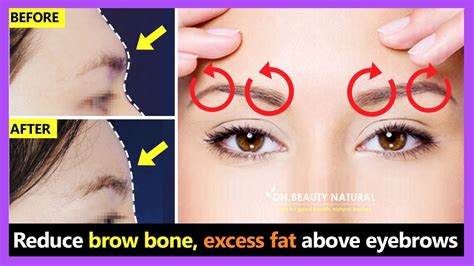 eyebrow bone pain when pressed