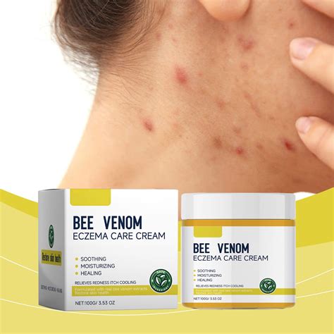 Face Cream For Itching