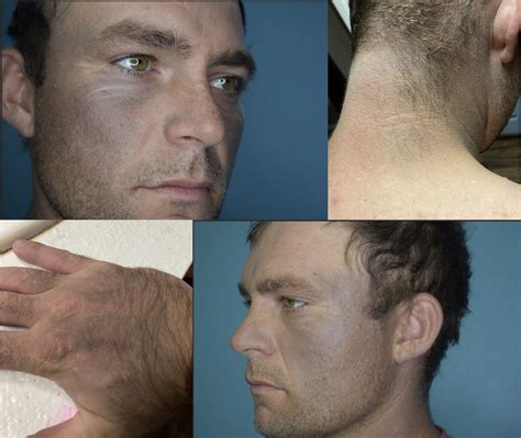 Face Flushing Kratom