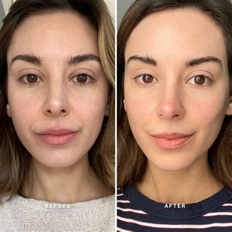 Face Serum Before Lotion