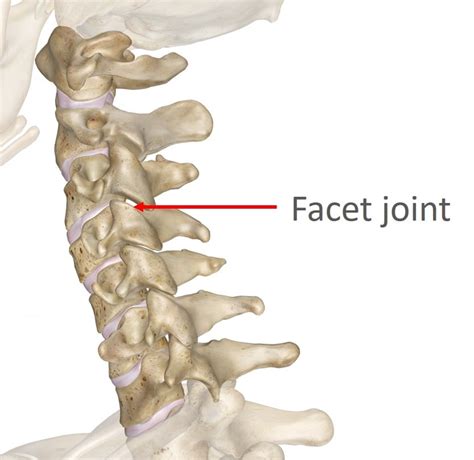 Facet Joint Neck