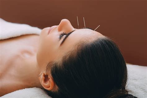 facial acupuncture near me benefits