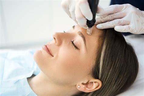 facial acupuncture vs microneedling