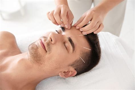 Facial Akupuntur