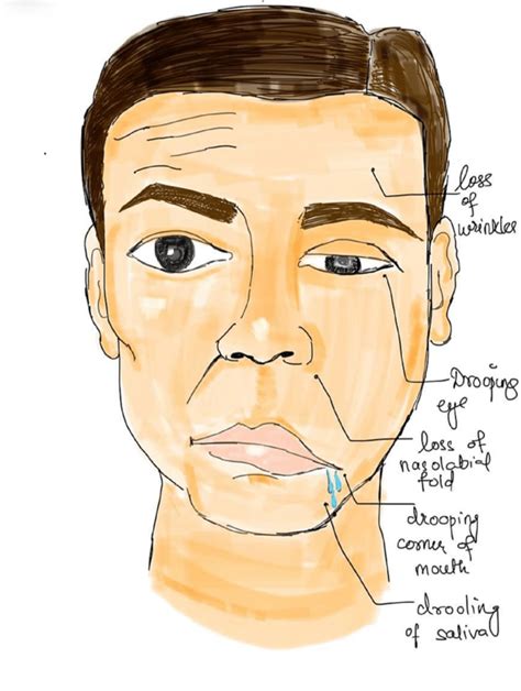 Facial Dysmorphia Art