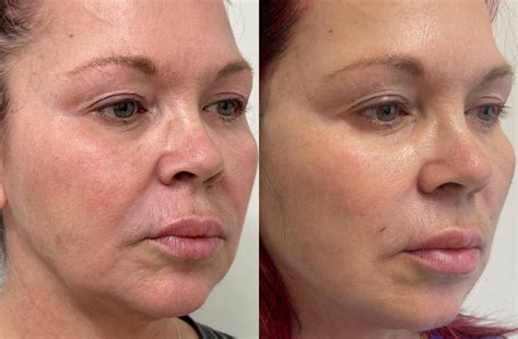 Full Face Threading Before & After Yelp