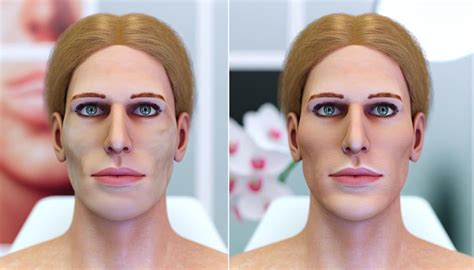 facial trans self