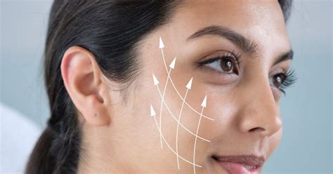 Factors Affecting the Longevity of a Thread Lift