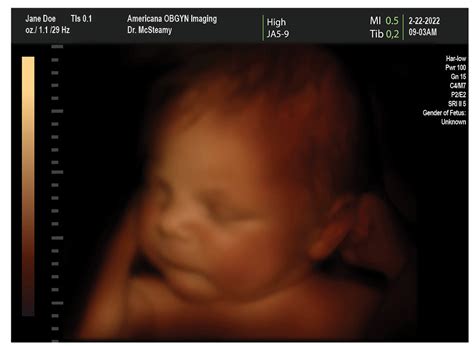 fake sonogram generator free