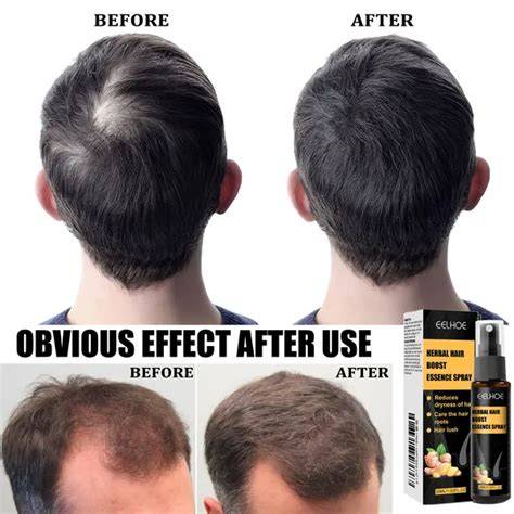 falling hair solution