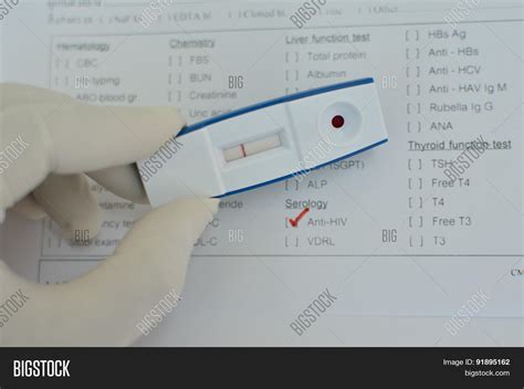 False Negative Hiv Test After 6 Weeks
