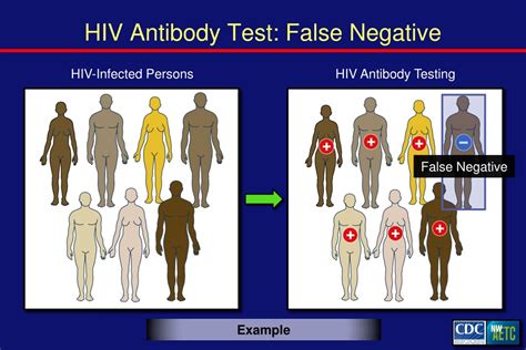 False Negative Hiv Test Causes