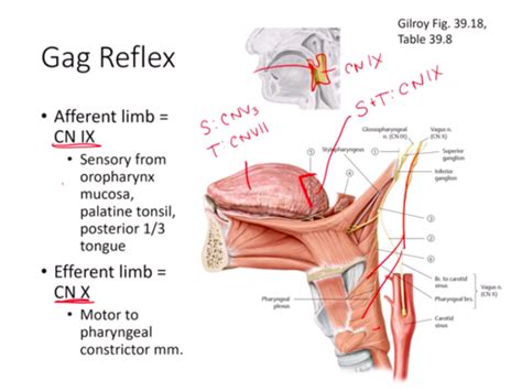 False Teeth Gag Reflex