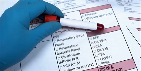 fasting for blood test results