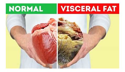 Fat Adalah What Is Visceral And How Does It Develop