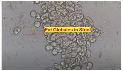 Fat Globules Adalah Clinical Benefits Of Milk Globule Membranes For Infants And