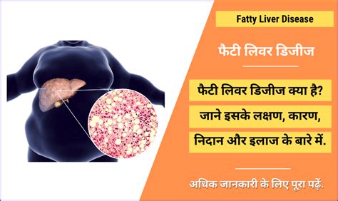 Fat Symptoms In Hindi