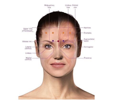 fda approved diagnosis for botox