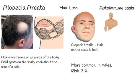 fda approved drugs for alopecia areata