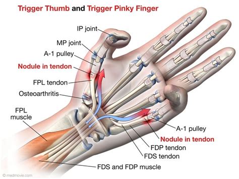 fdp and fds tendon in the finger