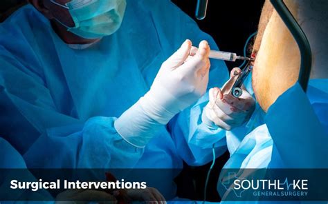 What to Expect from Female Hemorrhoidectomy Surgery Procedure